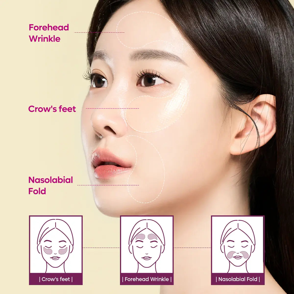 Woman's face with annotations for forehead wrinkle, crow's feet, and nasolabial fold on a beige background.