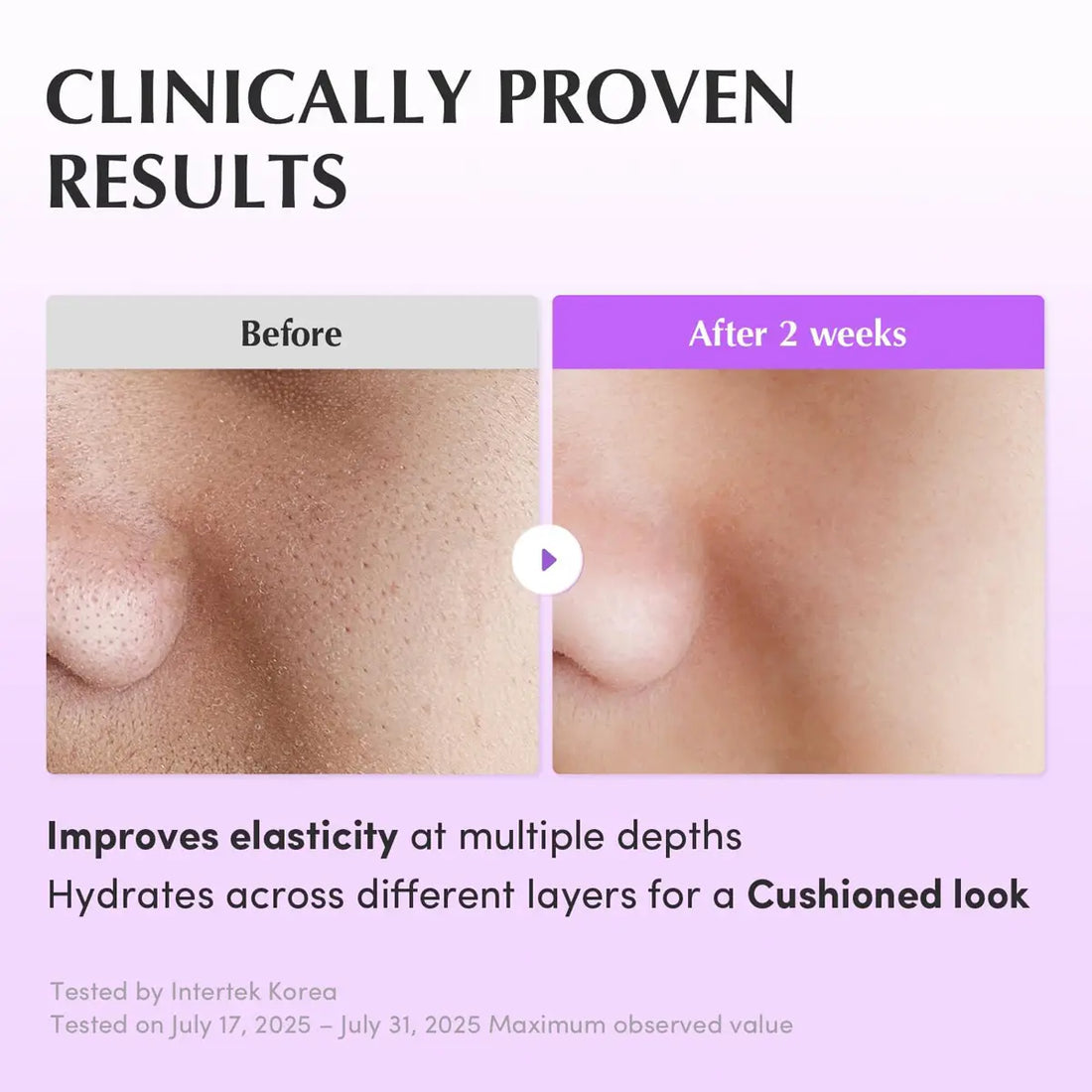 Before and after comparison of skin texture with text highlighting clinically proven results.