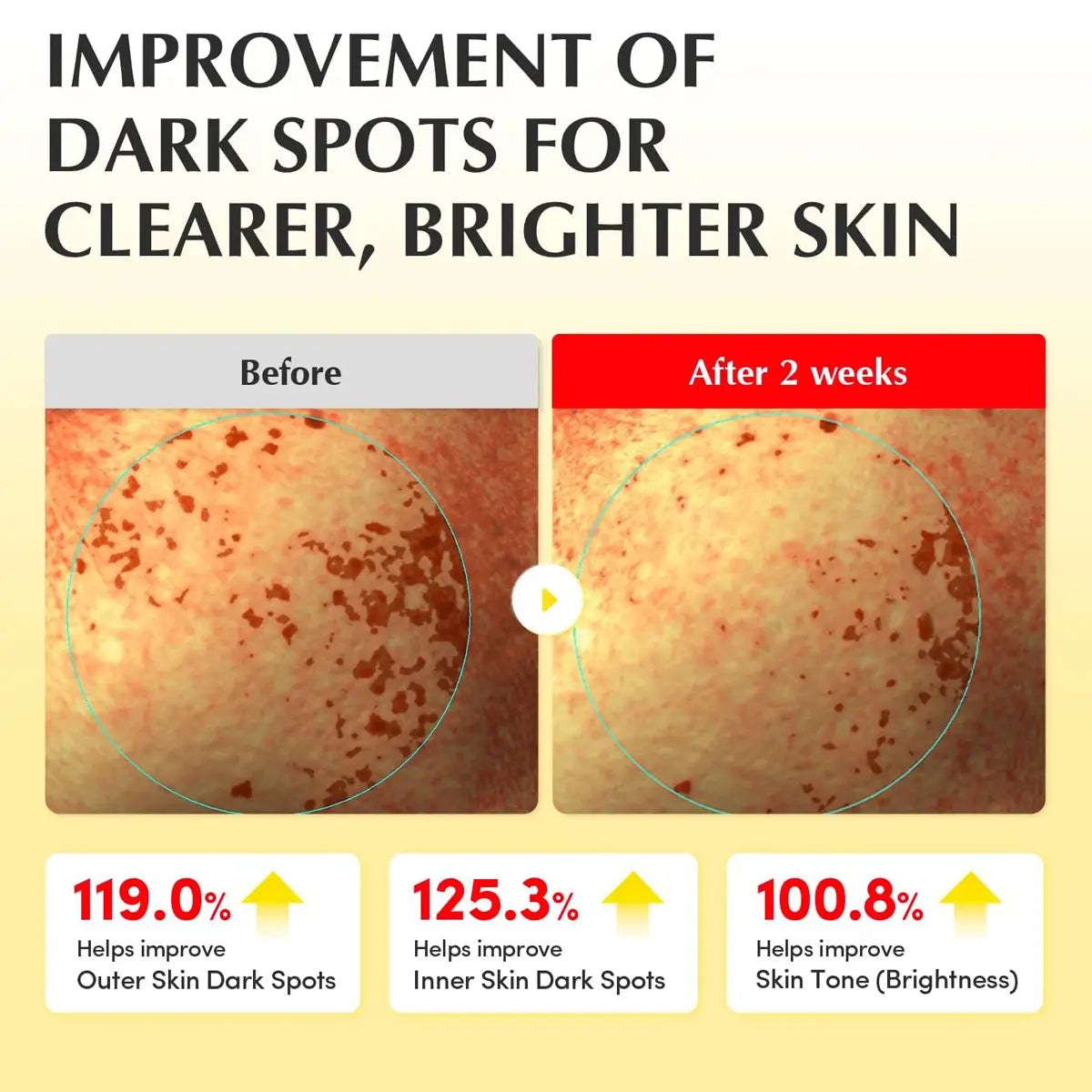 Before and after comparison of dark spots on skin with improvement percentages.