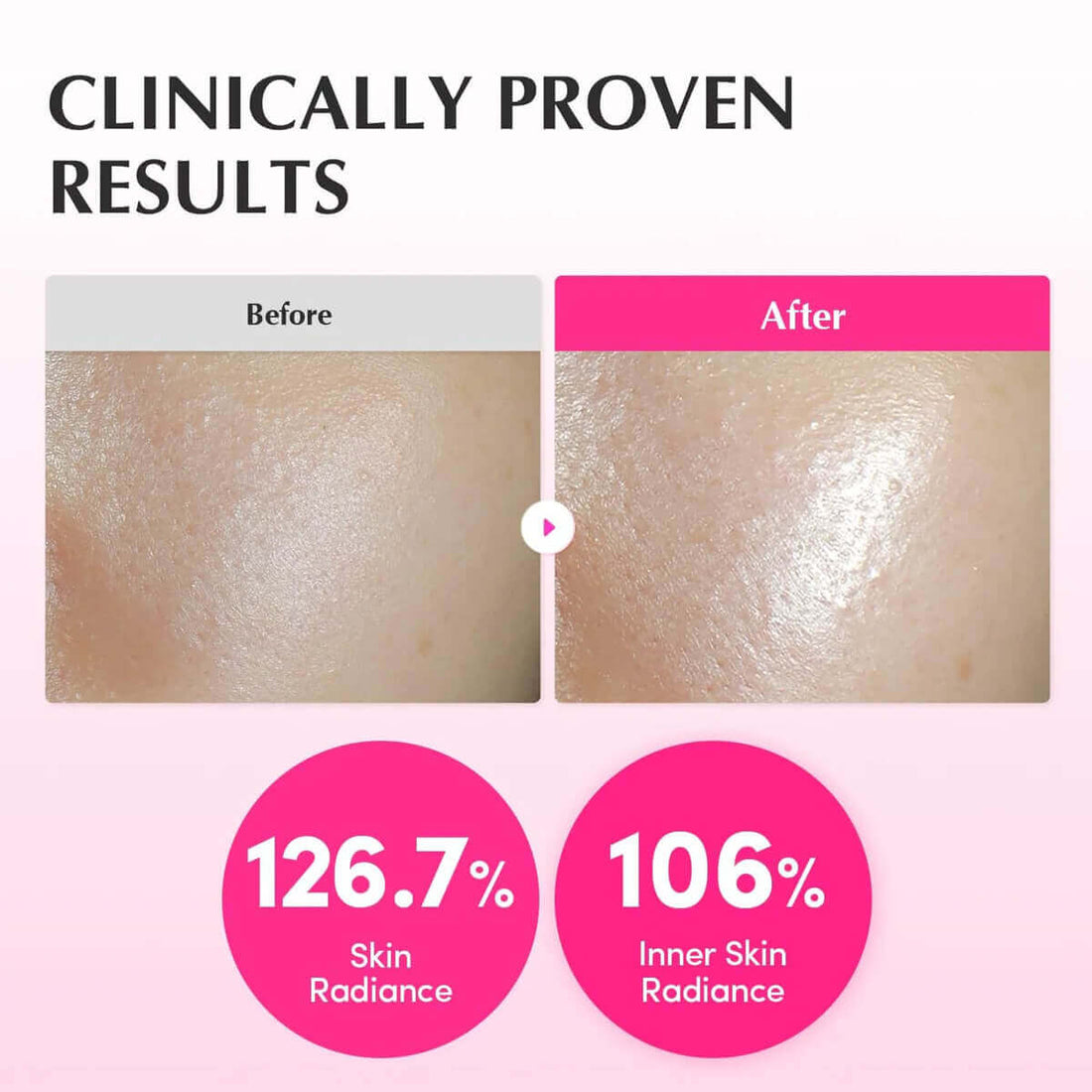 Before and after results of NAD+ peptide toner showing improved skin radiance of 126.7% and inner skin radiance of 106%.