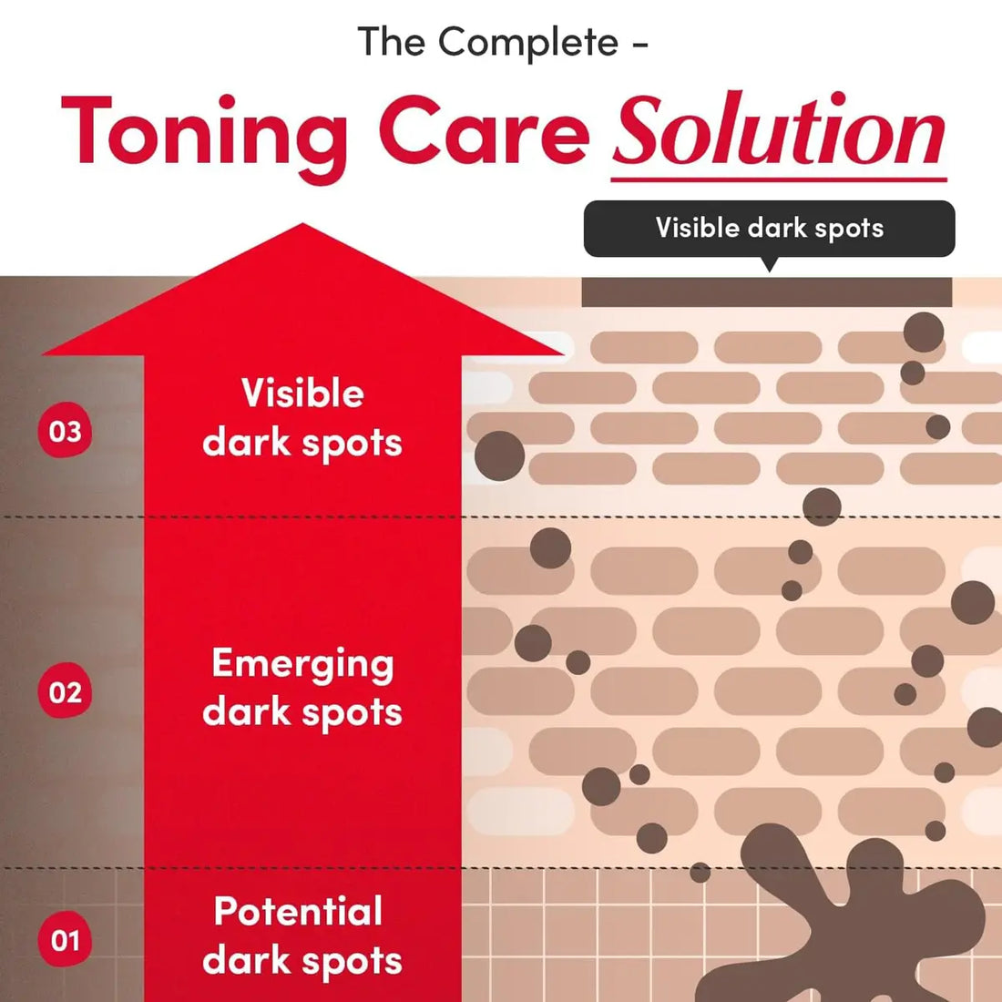 Diagram titled 'The Complete Toning Care Solution' showing stages of dark spot development.