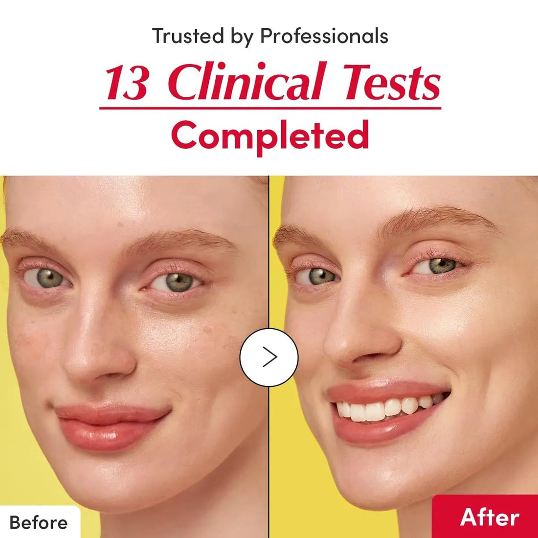 Before and after comparison of a woman's face with clinical test results displayed.