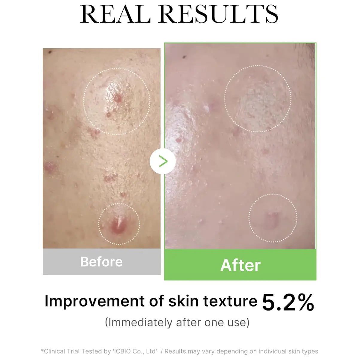 Medicube Exosome Cica Serum before & after