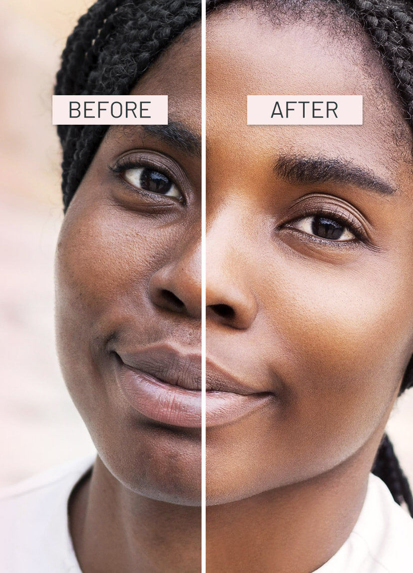 Before and after comparison of a woman's face with a neutral background