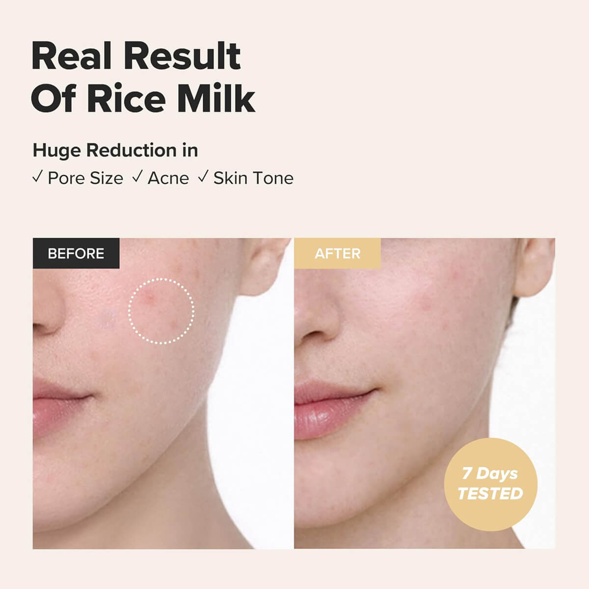 Before and after comparison of rice milk's effect on skin with text indicating pore size, acne, and skin tone improvements.