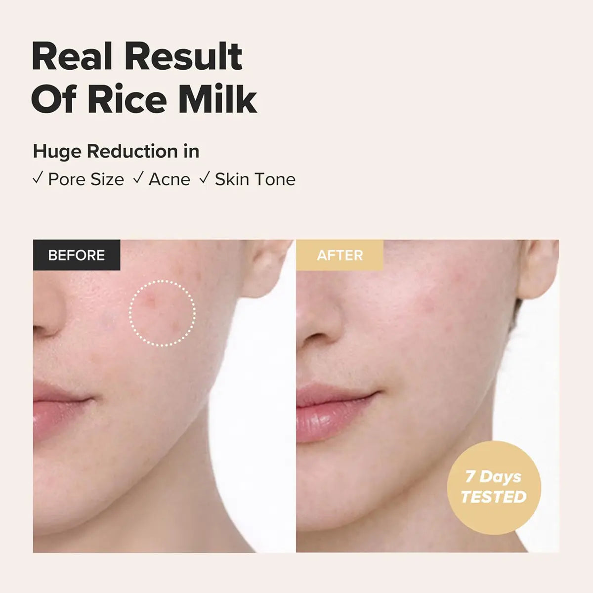 Before and after comparison of rice milk's effect on skin with text indicating pore size, acne, and skin tone reduction.