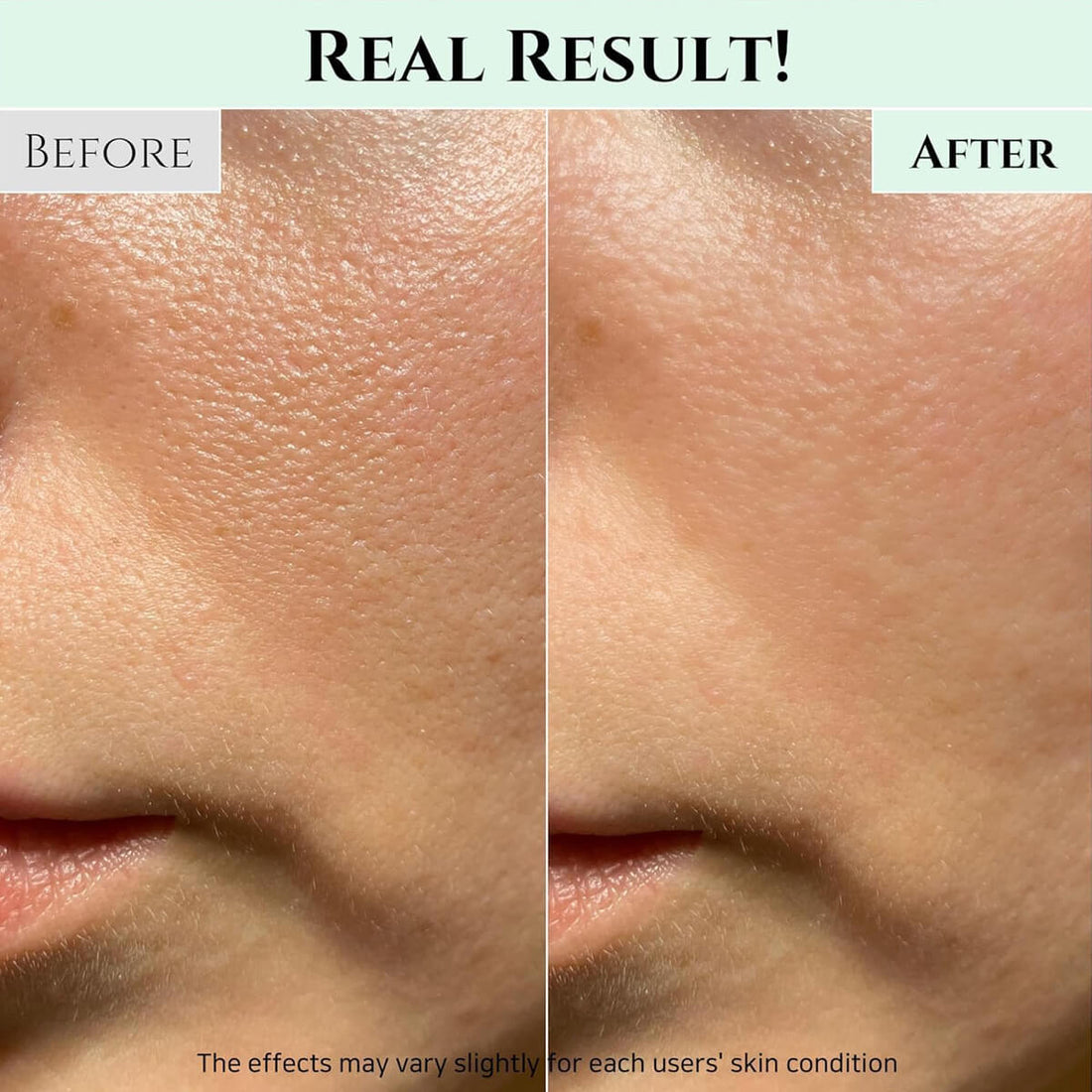 Before and after comparison of skin texture on a person's face.