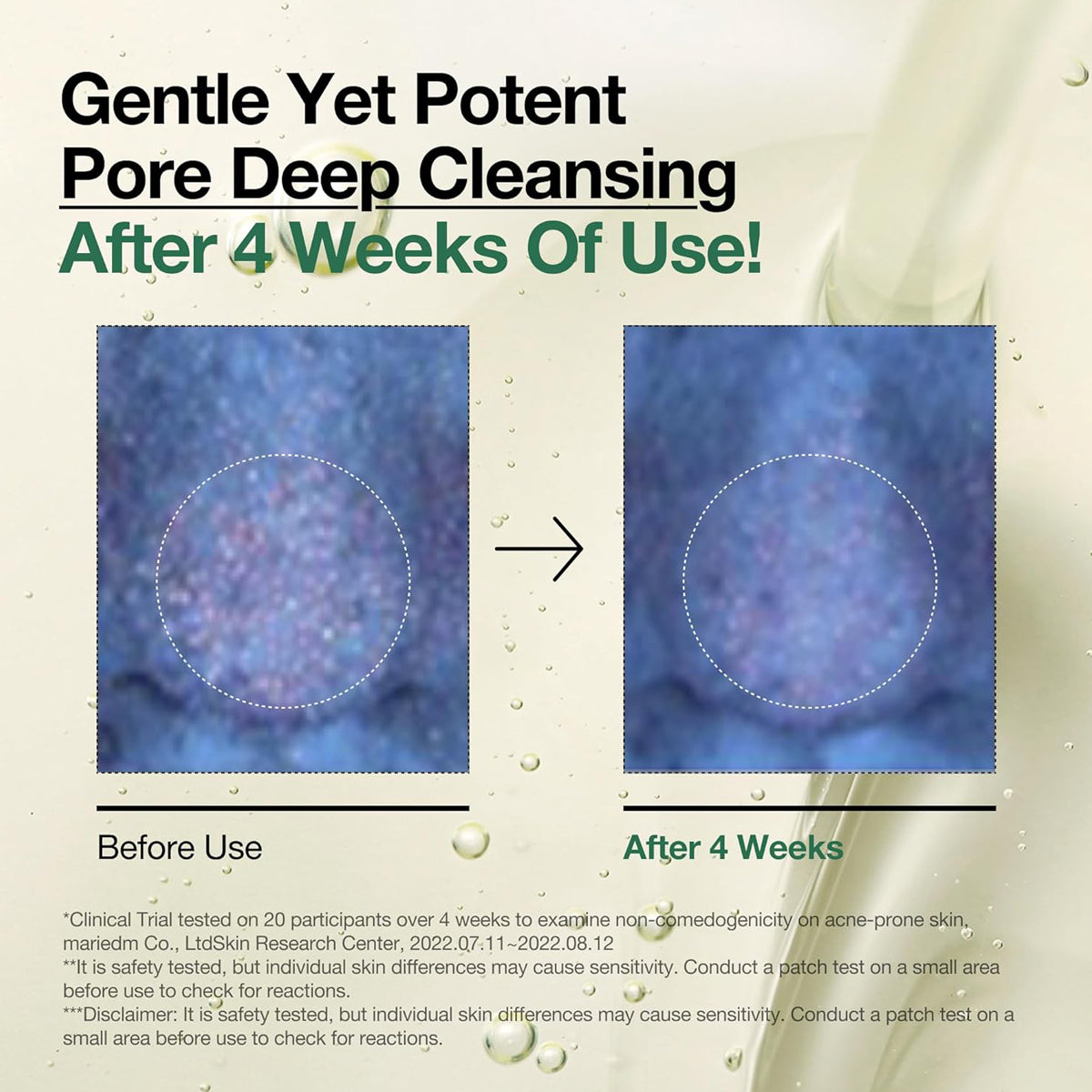 Before and after effect of pore deep cleansing product on skin texture.