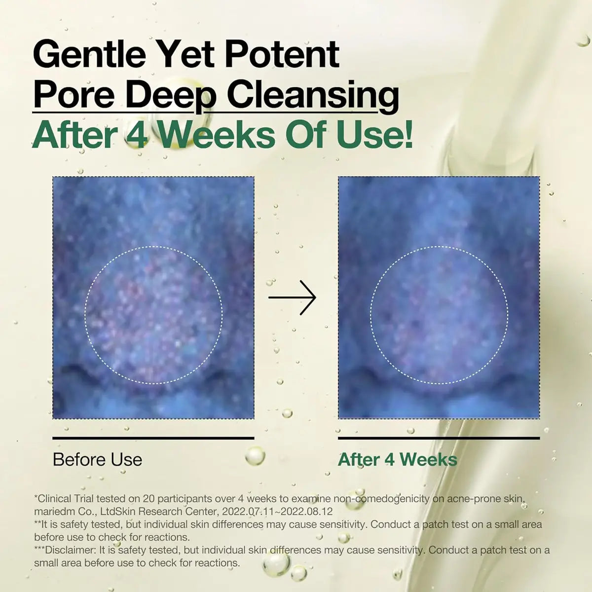 Before and after effect of a pore deep cleansing product on skin texture.