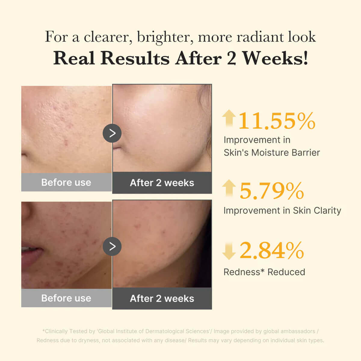 Before and after results of Kojic Acid Turmeric Niacinamide Serum showing skin improvements after 2 weeks.