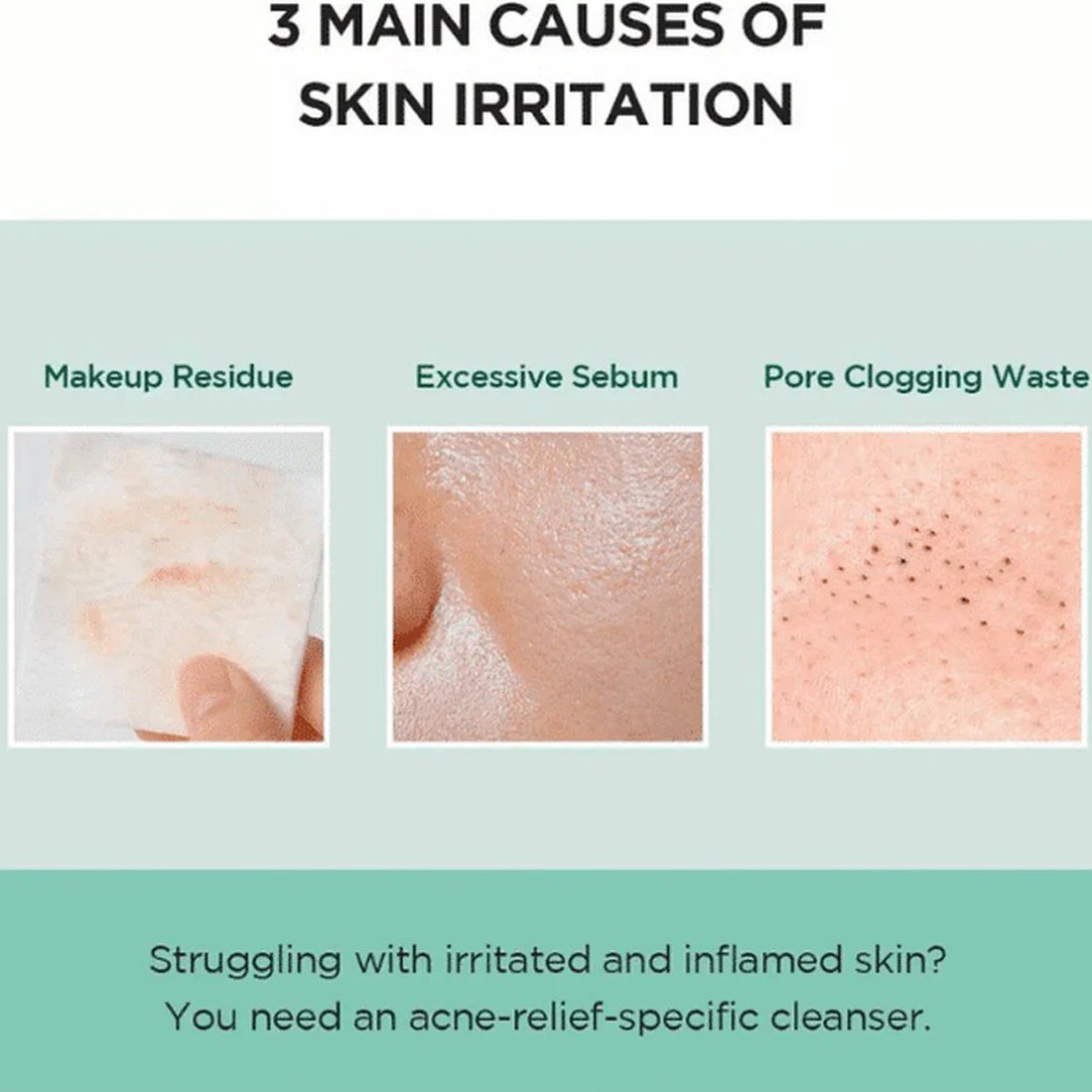 Diagram showing three main causes of skin irritation with corresponding images and text.