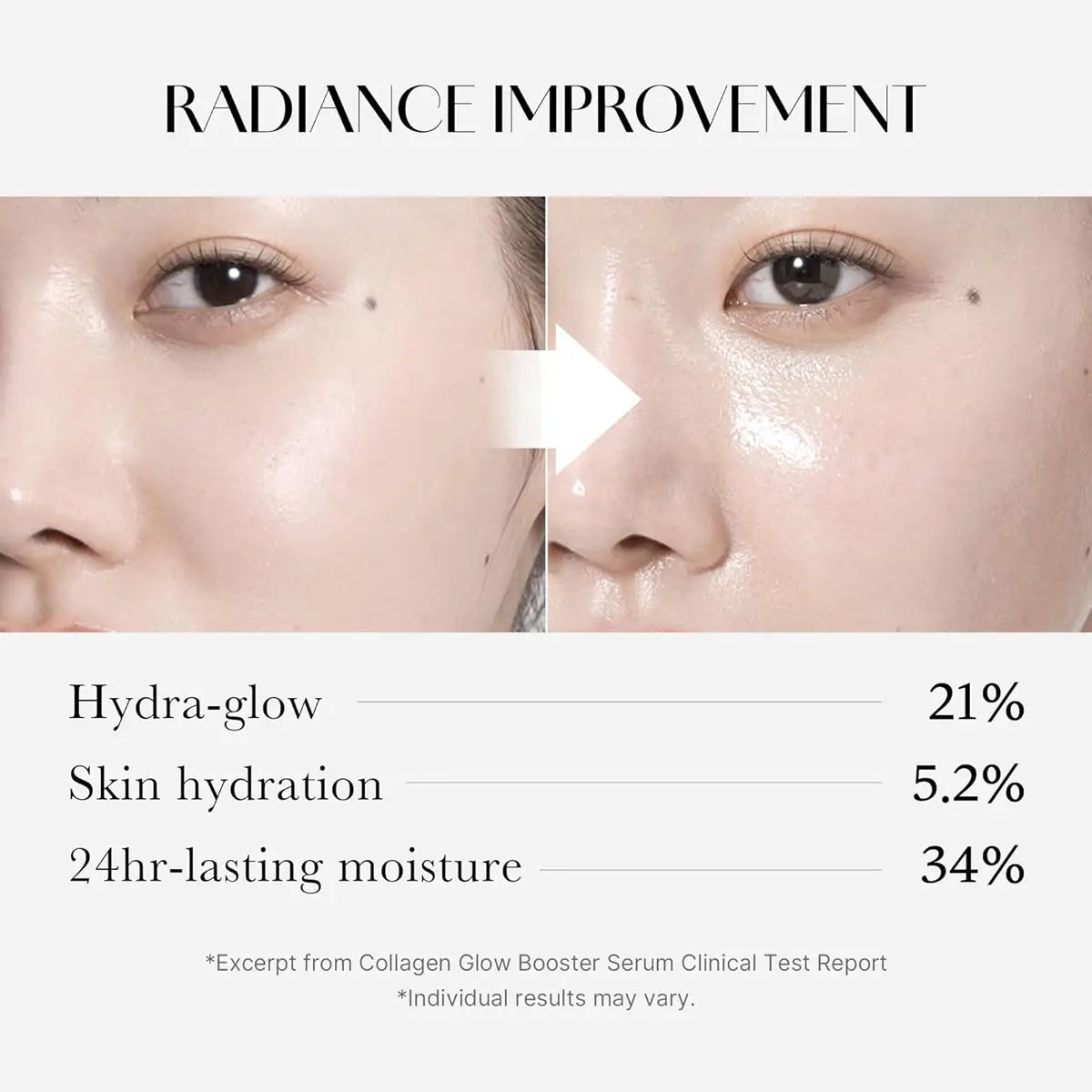 Before and after comparison of a person's face with radiance improvement text and percentages.