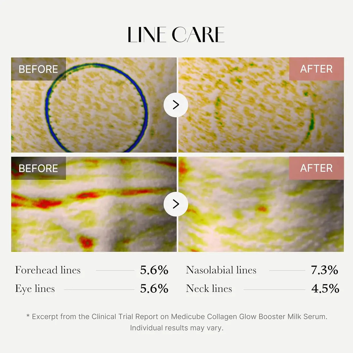 Before and after line care treatment results with percentage increases on a clinical trial report.