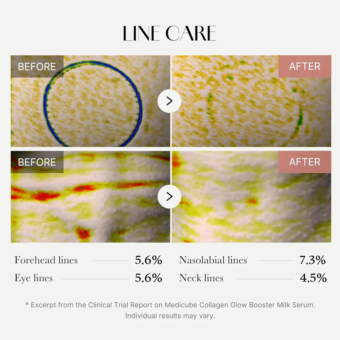 Before and after line care treatment results with percentage increases on a clinical trial report.