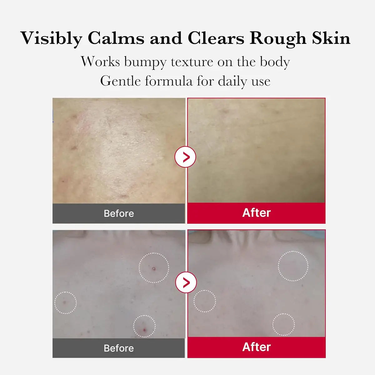 Before and after comparison of skin texture with text indicating product benefits.