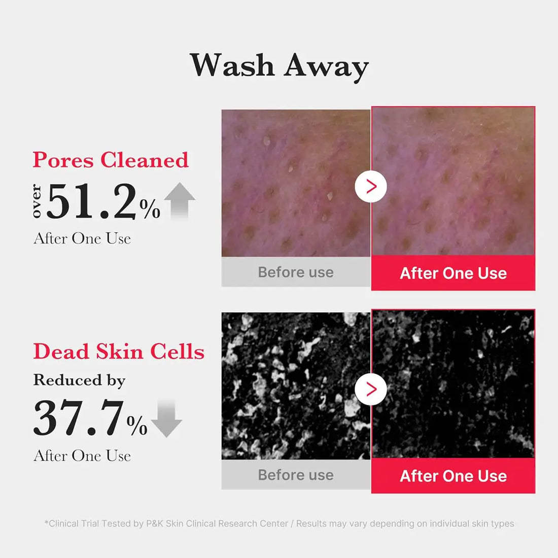 Before and after effects of a skincare product on skin pores and dead skin cells with statistical data.