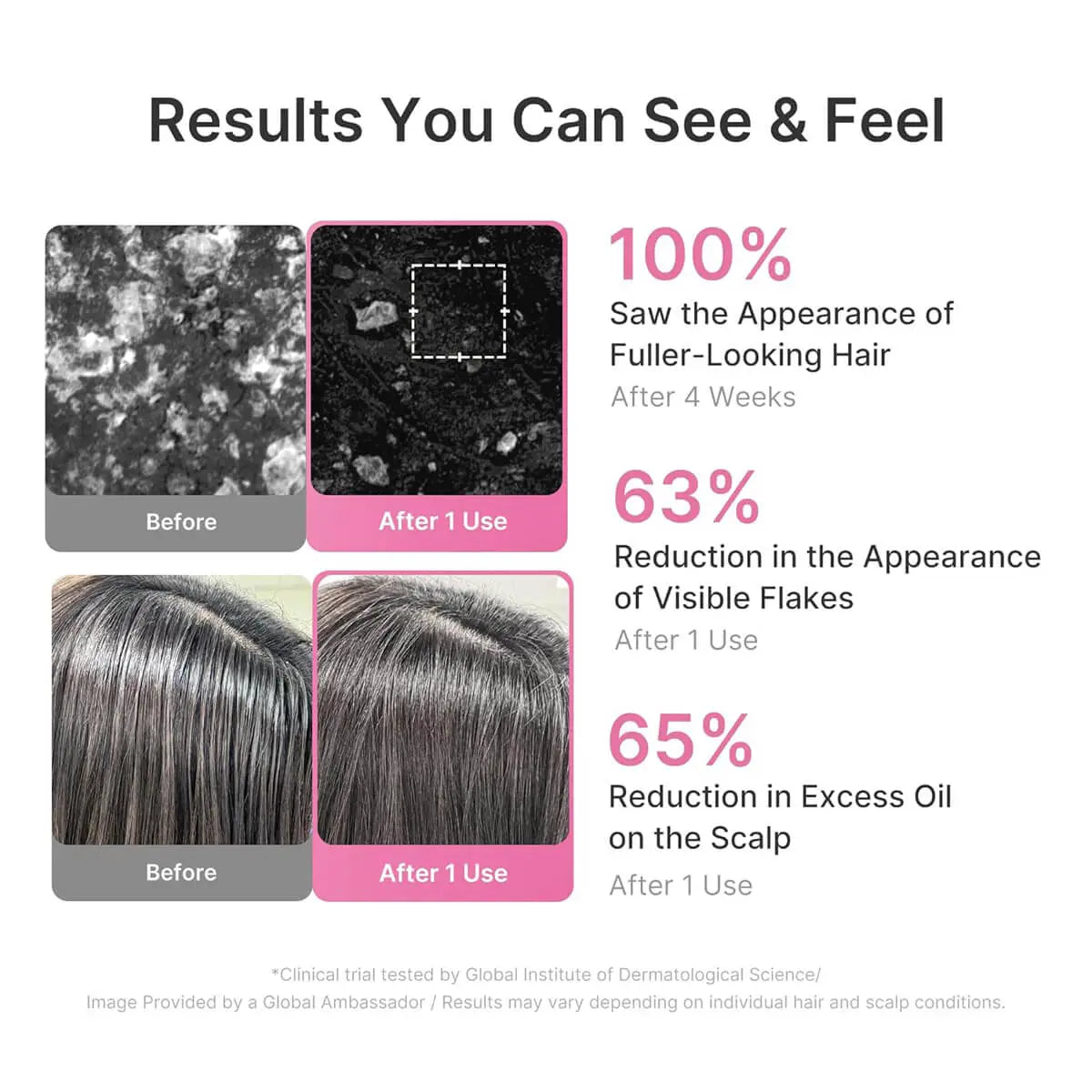 Product advertisement showing hair before and after use with statistical claims on hair and scalp benefits.