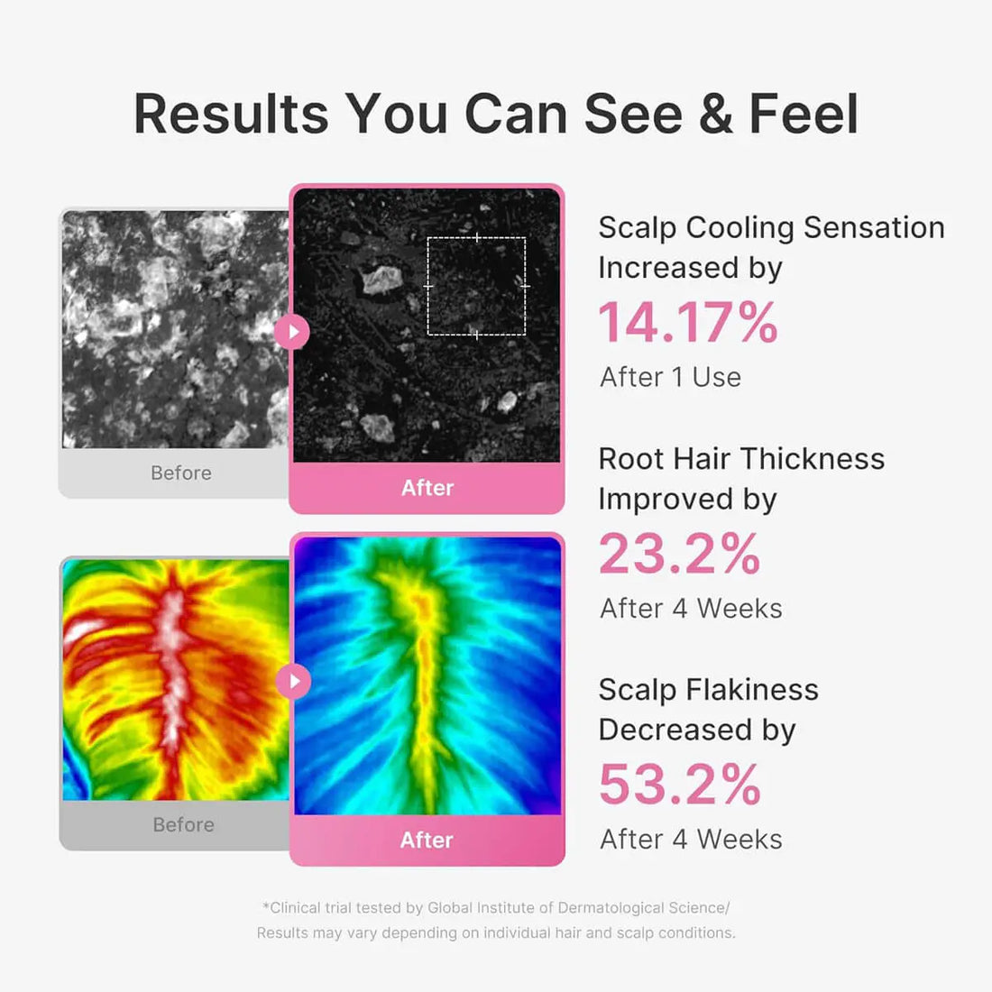 Before and after images of scalp and hair with text showing improvement percentages.