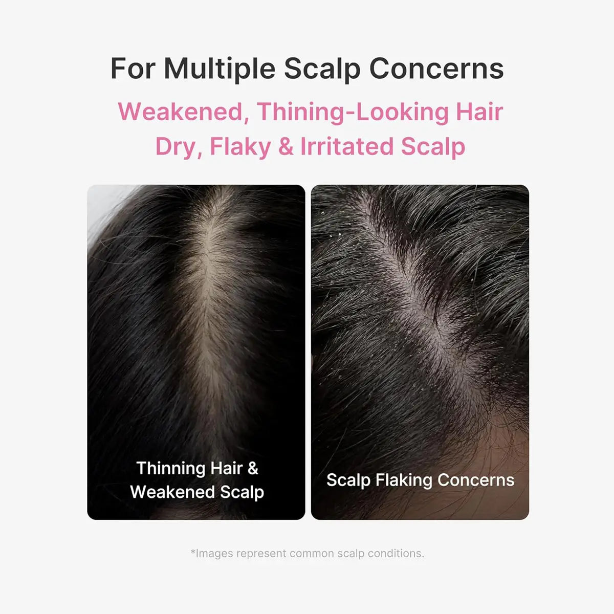 Advertisement for scalp care product showing images of thinning hair and flaky scalp with text indicating it addresses multiple scalp concerns.