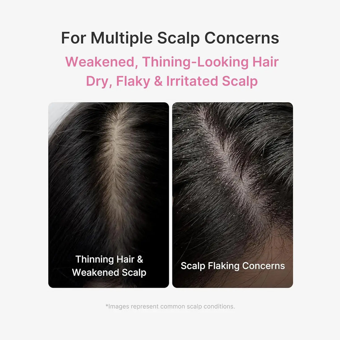 Advertisement for scalp care product showing images of thinning hair and flaky scalp with text indicating it addresses multiple scalp concerns.