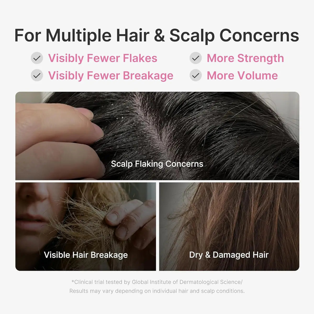 Advertisement for hair and scalp care product with text and images of scalp and hair issues.