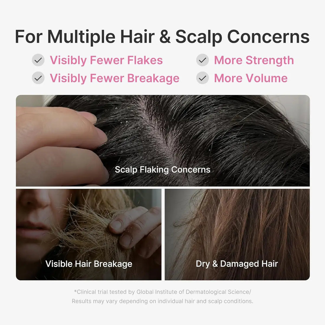 Advertisement for hair and scalp care product with text and images of scalp and hair issues.