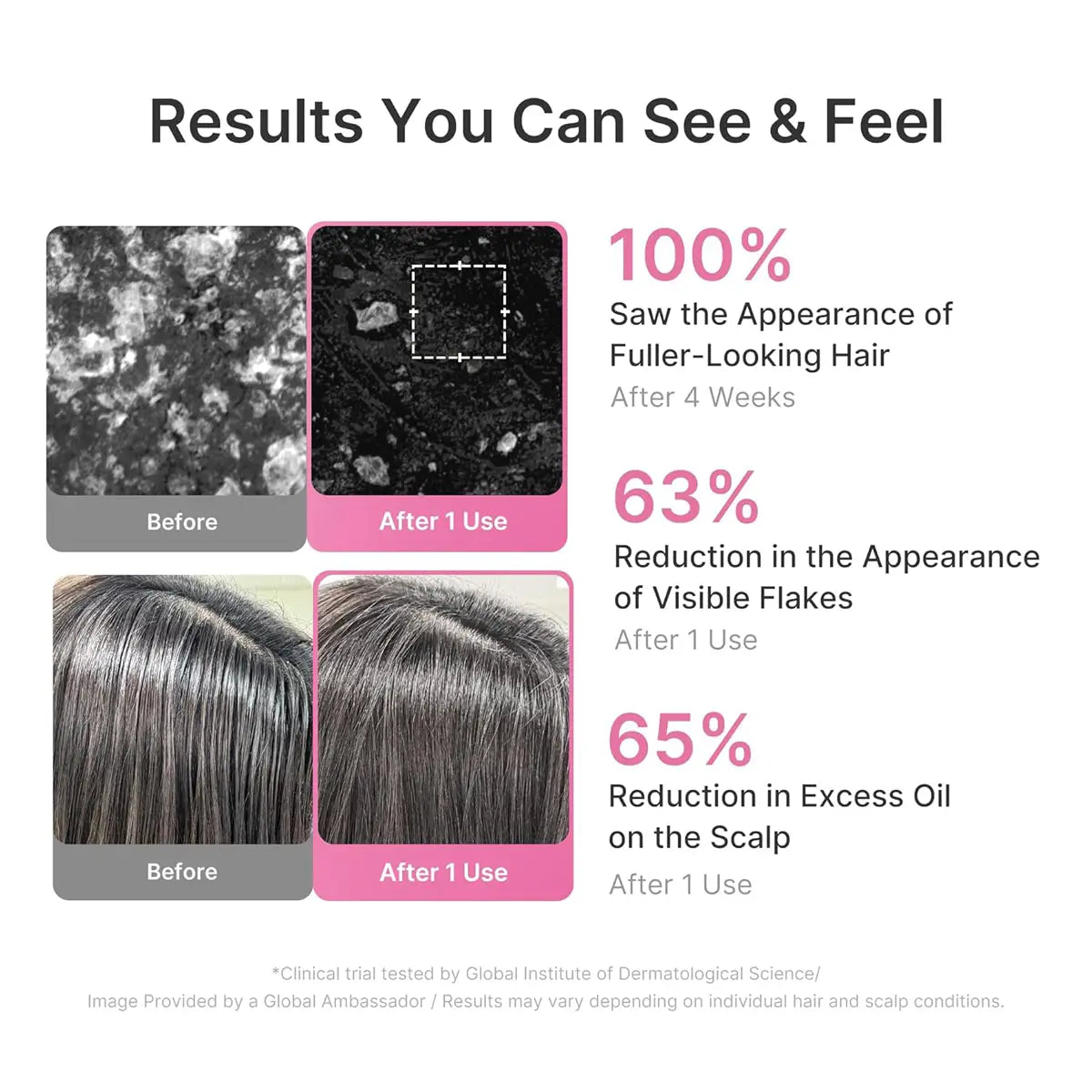 Product advertisement showing hair before and after use with statistical claims on hair and scalp benefits.