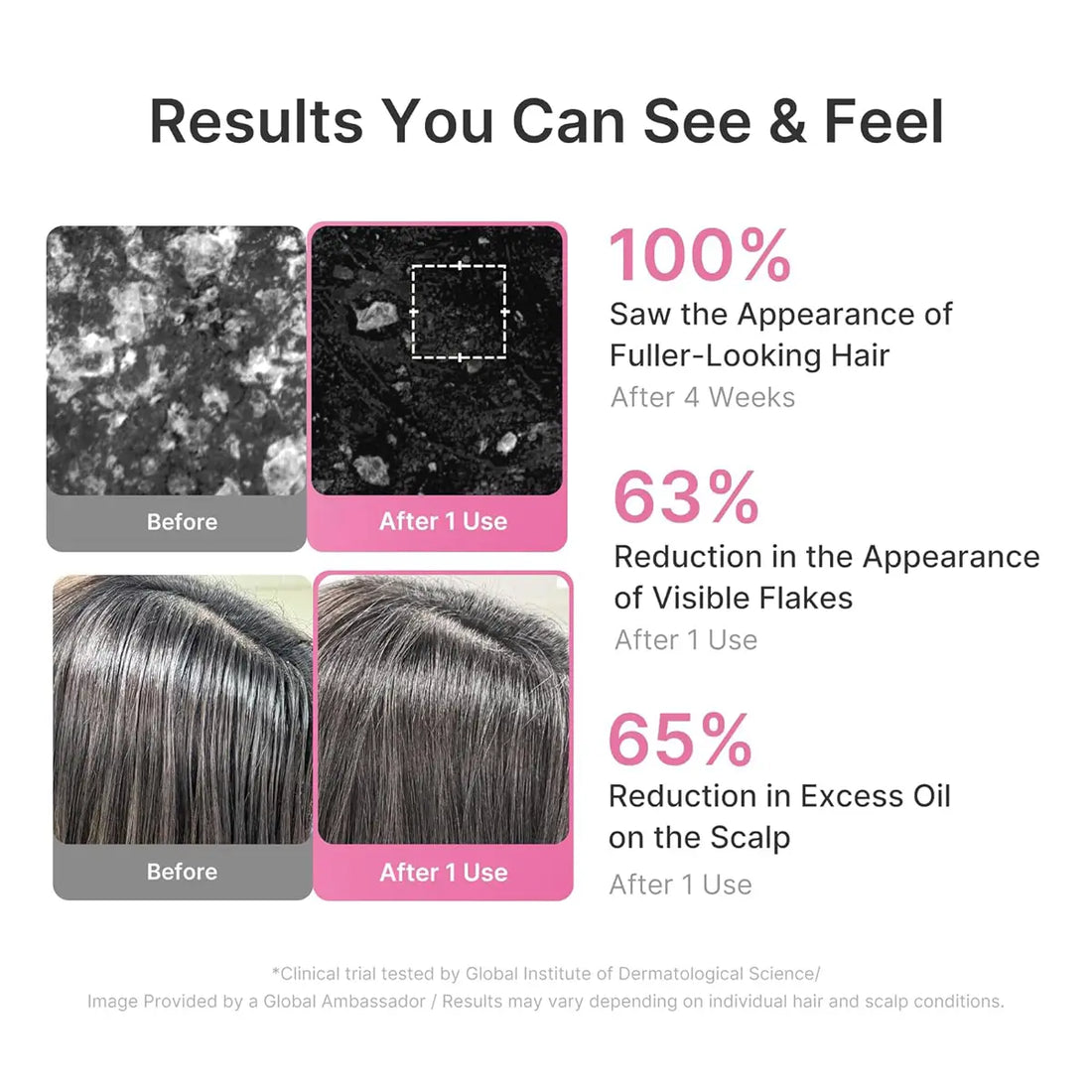 Product advertisement showing hair before and after use with statistical claims on hair and scalp benefits.