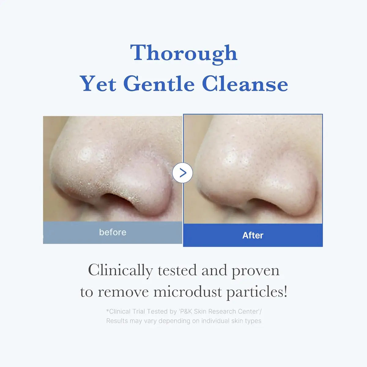 Before and after comparison of a nose with text indicating a thorough yet gentle cleanse.