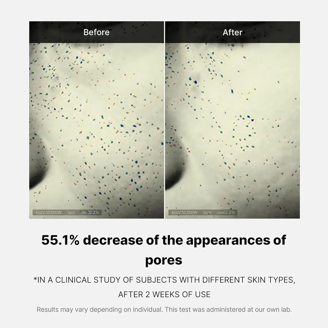 Before and after comparison of skin texture with text indicating pore reduction.
