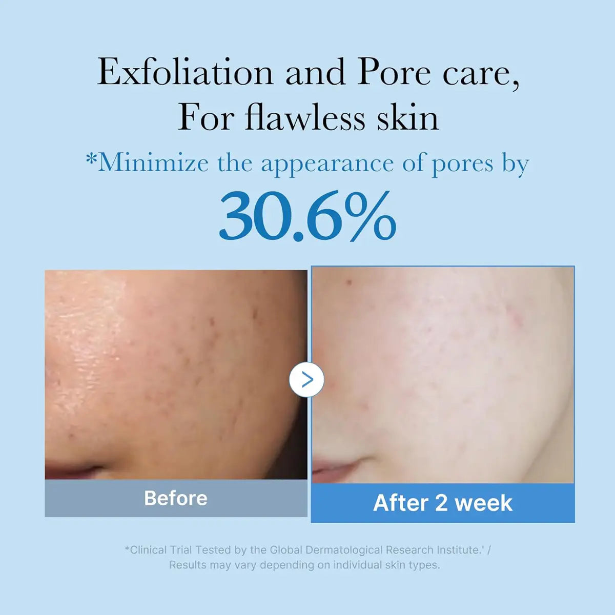 Before and after skin care treatment showing exfoliation and pore care results.