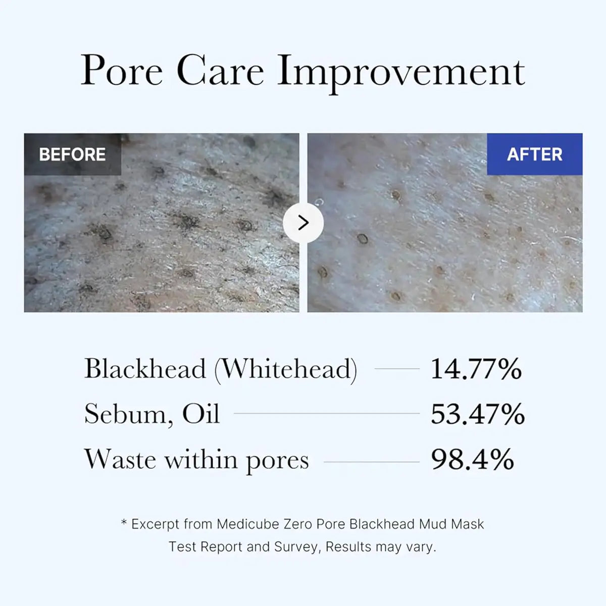 Before and after comparison of pore care improvement with statistical data on skin issues.