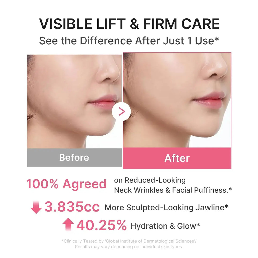 Before-and-after comparison graphic showing a woman's lower face and neck, with text claiming visible lift and firm care, reduced neck wrinkles, a more sculpted jawline, and increased hydration and glow.