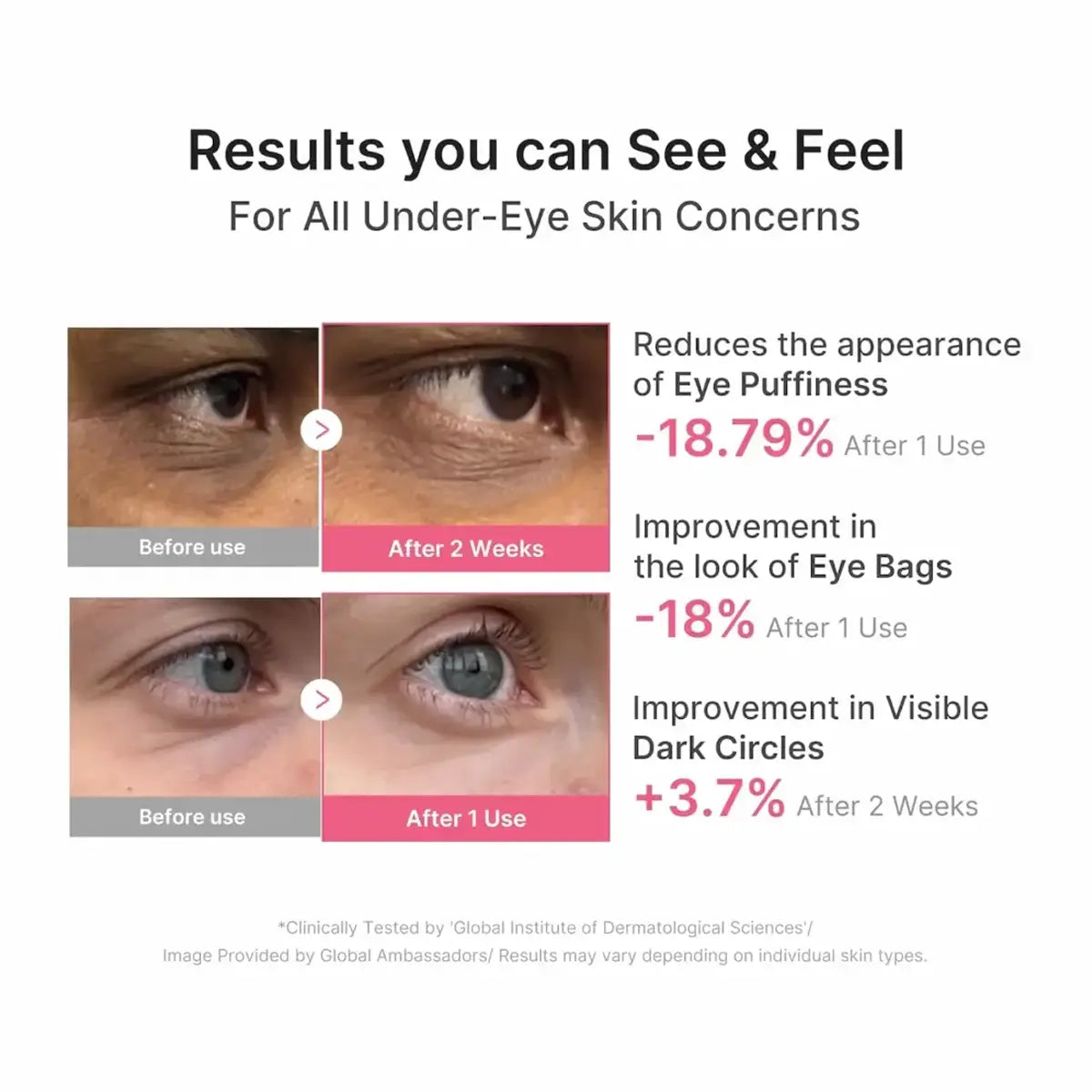 A promotional infographic showing before-and-after eye area results for under-eye skin concerns. It contains four close-up eye comparison panels labeled before use and after 1 use and after 2 weeks, with text stating results for reducing eye puffiness, improving the look of eye bags, and improving visible dark circles.