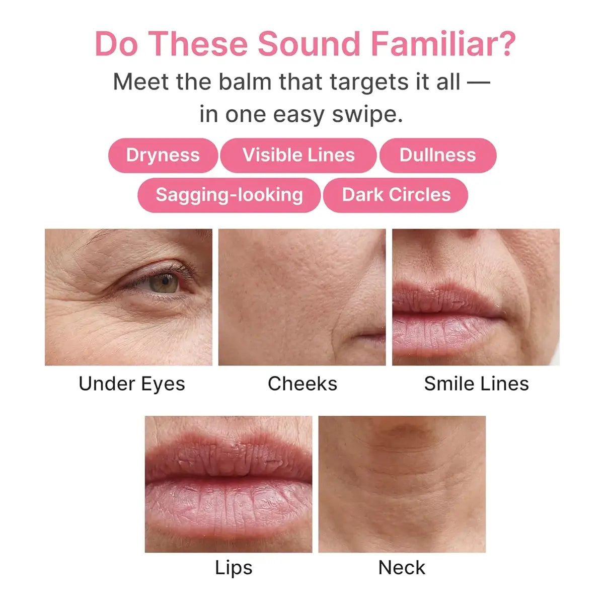 Promotional graphic for a skincare balm, featuring before-and-after style close-up photos of under eyes, cheeks, smile lines, lips, and neck wrinkles, with text listing skin concerns such as dryness, visible lines, dullness, sagging-looking texture, and dark circles.