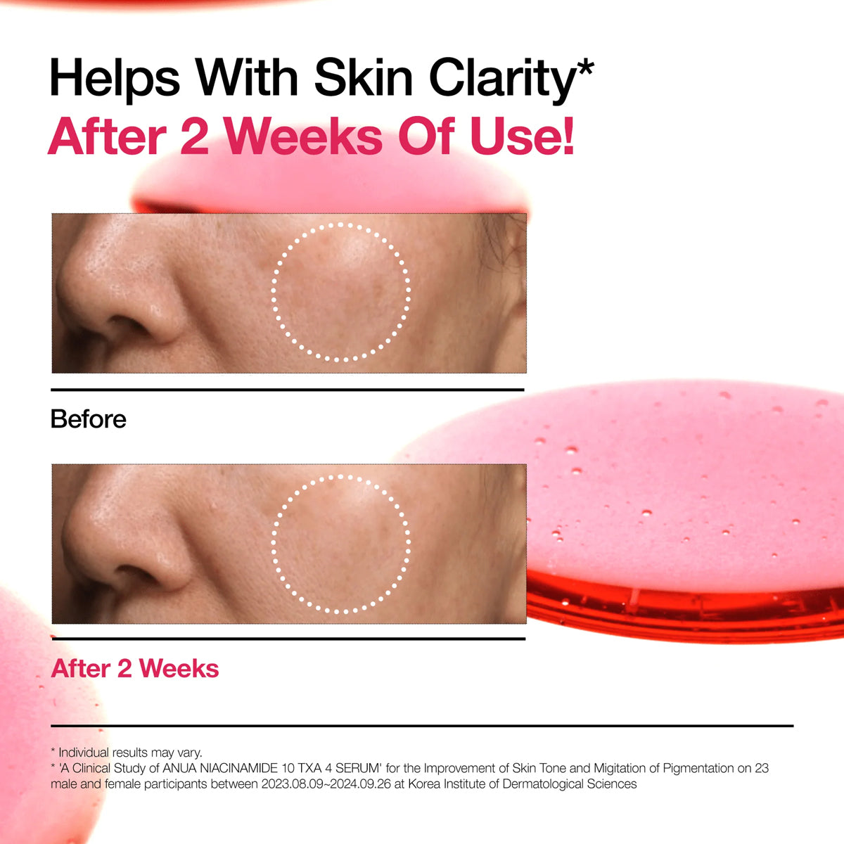 Product advertisement showing before and after effects on skin with a pink compact.