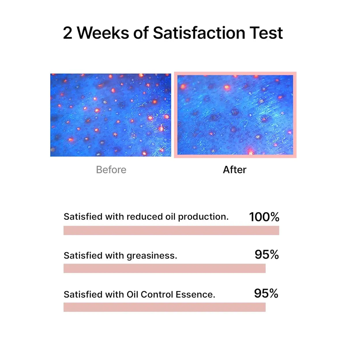 Before and after comparison of skin texture with satisfaction percentages displayed.
