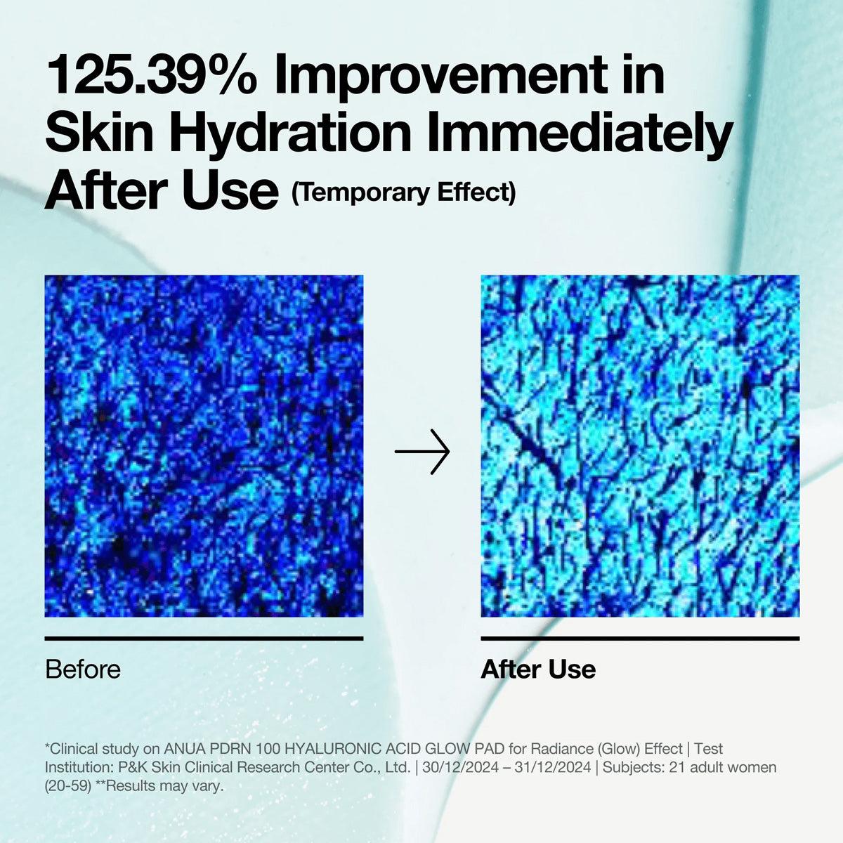 Before and after comparison of skin hydration with blue textured patterns on a light blue background.