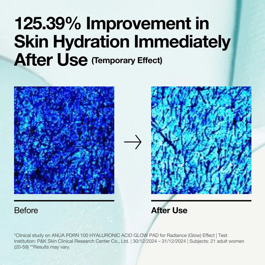 Before and after effect of skin hydration improvement with blue textured patterns.