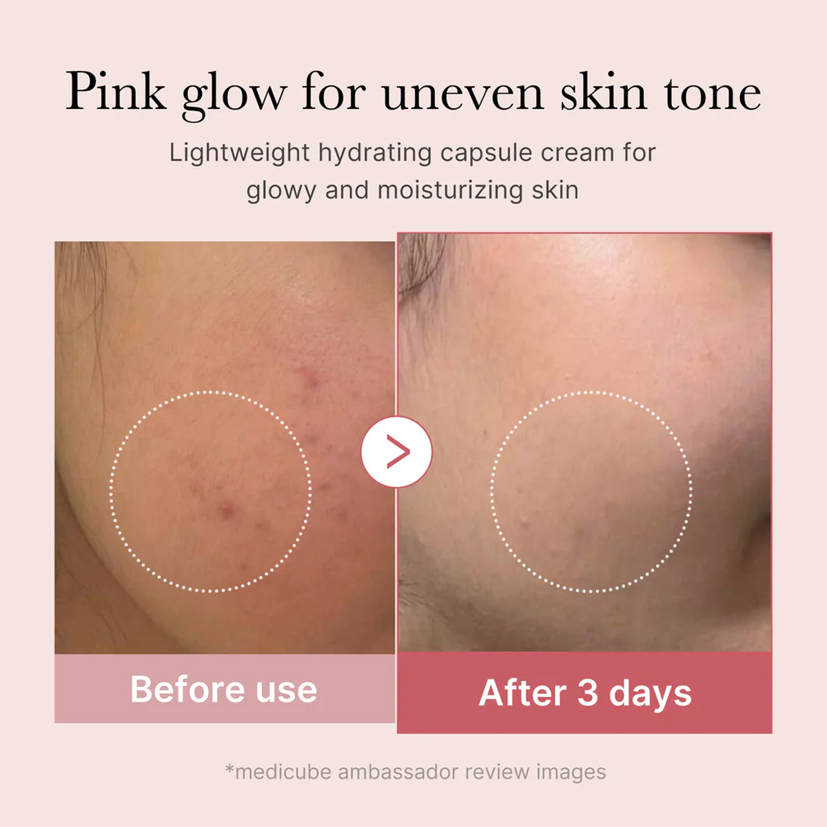 Before and after comparison of skin tone improvement with a hydrating cream, showing a pink glow for uneven skin tone.