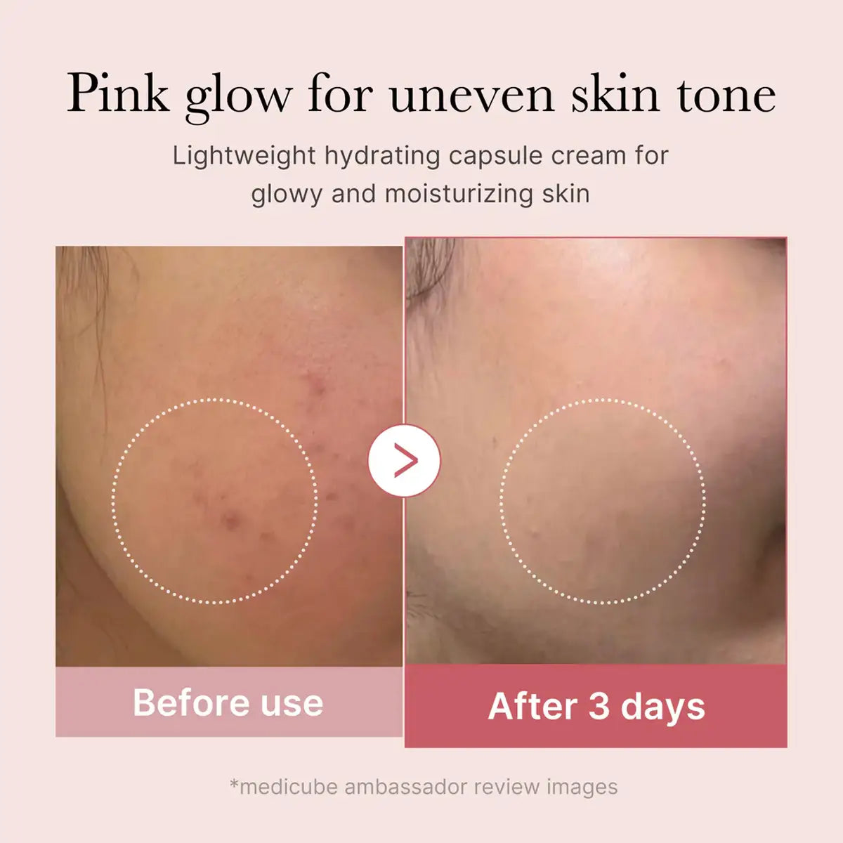 Before and after comparison of skin tone improvement with a hydrating cream, showing a pink glow.