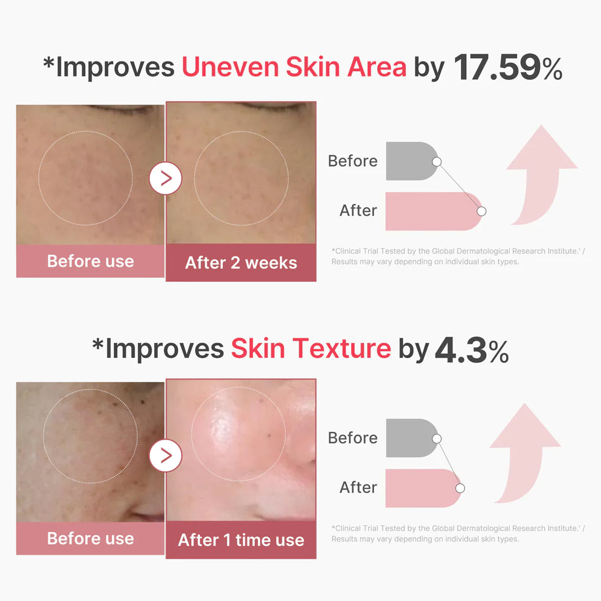 Before and after skin improvement results with text indicating percentage improvements.
