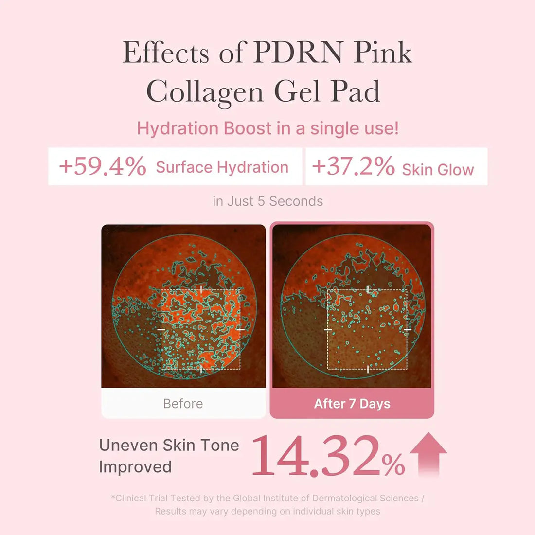 Advertisement for PDRN Pink Collagen Gel Pad showing before and after effects on skin.