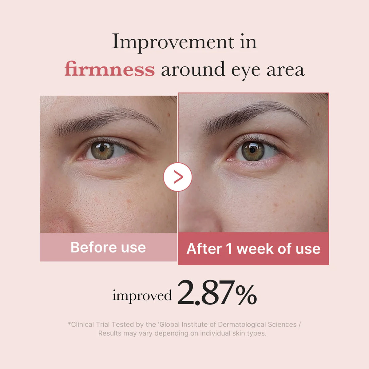 Before and after comparison of eye area firmness improvement with text on a beige background