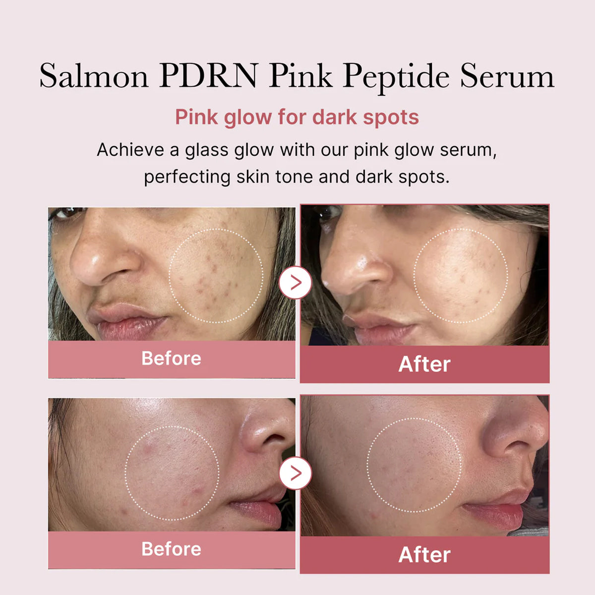 Advertisement for Salmon PDRN Pink Peptide Serum showing before and after effects on skin.