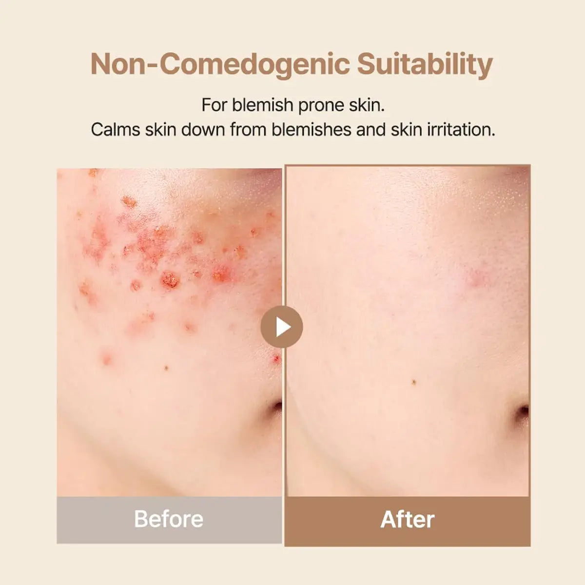 Purito Oat-in Calming Gel Cream Before & After