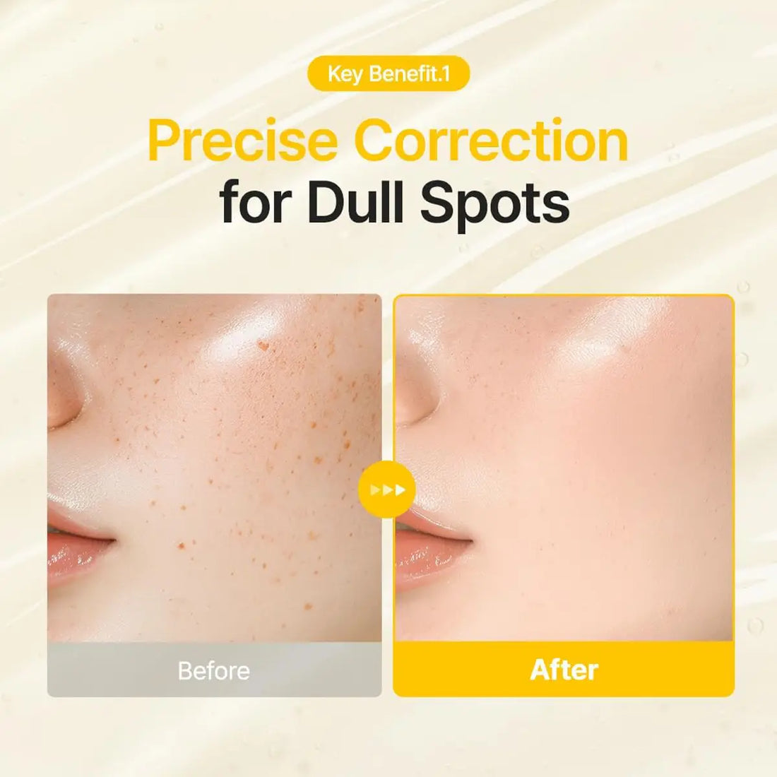 Before and after comparison of skin with dull spots correction on a beige background