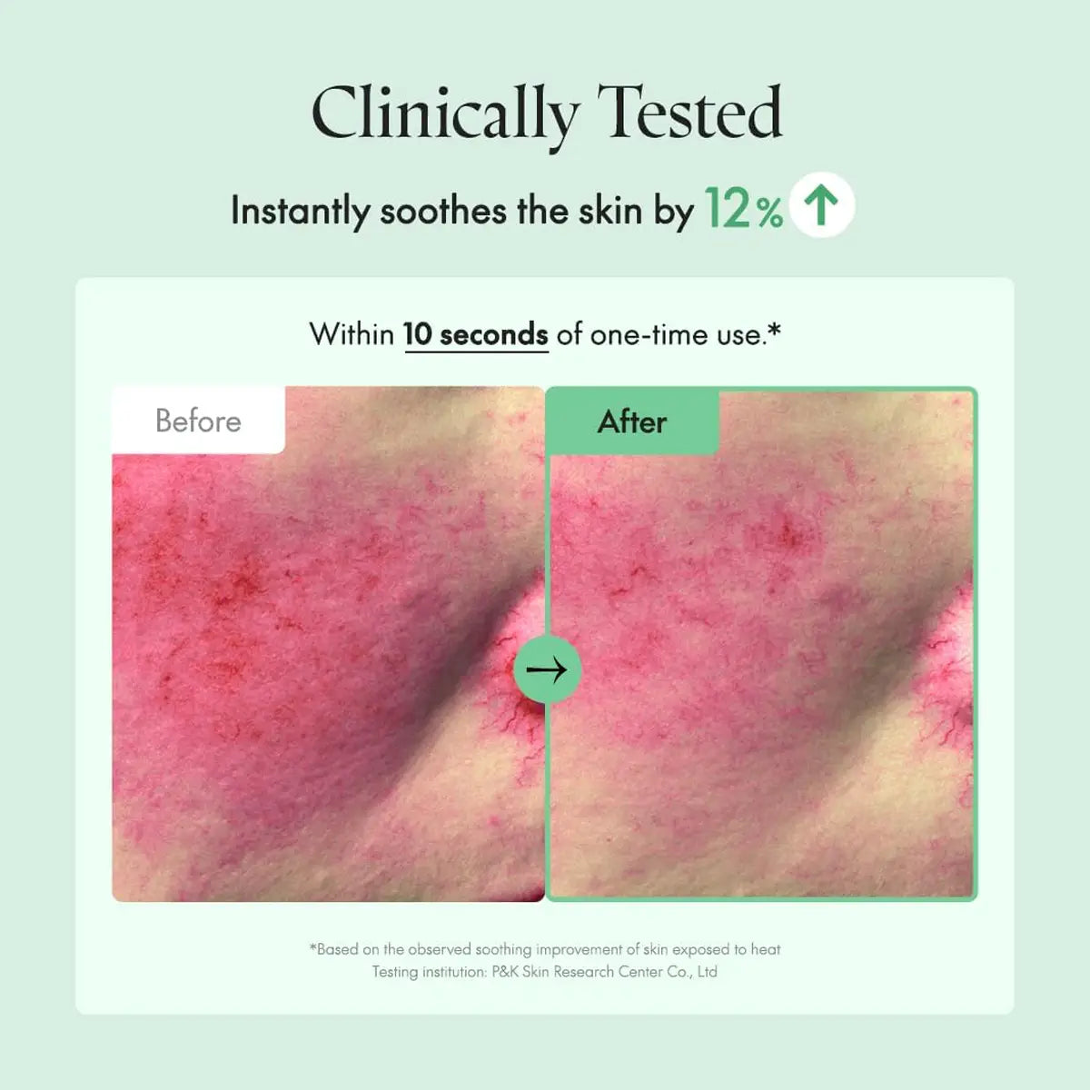 Before and after skin comparison with text indicating clinical testing and skin soothing effects.