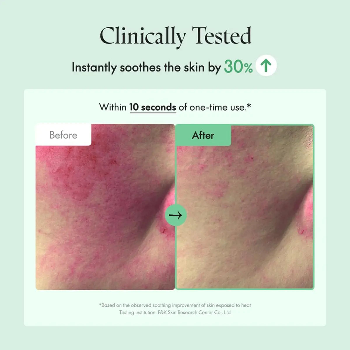 Before and after skin comparison with text indicating clinical testing and skin soothing effects.