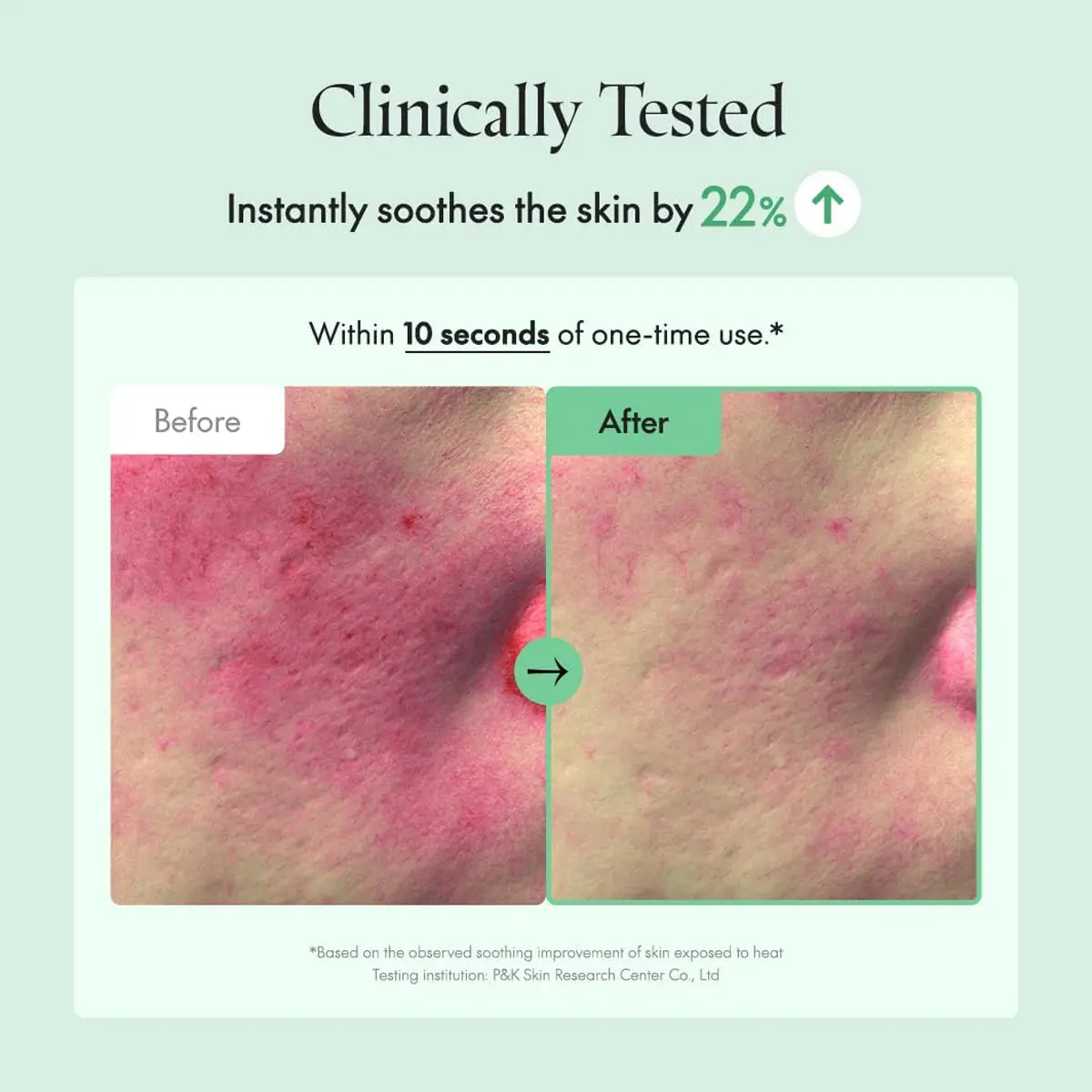 Before and after skin comparison with text indicating clinical testing and skin soothing benefits.